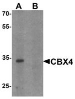 CBX4 Antibody in Western Blot (WB)