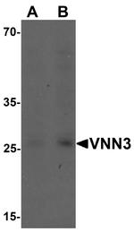 VNN3 Antibody in Western Blot (WB)