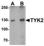 TYK2 Antibody in Western Blot (WB)