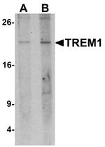 TREM1 Antibody in Western Blot (WB)