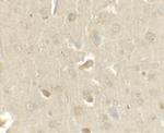 CCL4 Antibody in Immunohistochemistry (IHC)