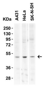 KREMEN2 Antibody in Western Blot (WB)