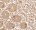 MTERFD2 Antibody in Immunohistochemistry (IHC)