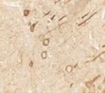 PRRT2 Antibody in Immunohistochemistry (IHC)