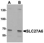 SLC27A6 Antibody in Western Blot (WB)