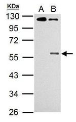 Phospho-CHK1 (Ser345) Antibody in Western Blot (WB)