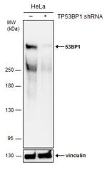 53BP1 Antibody