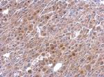 TNFAIP2 Antibody in Immunohistochemistry (Paraffin) (IHC (P))