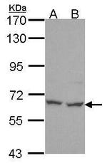 PNK Antibody in Western Blot (WB)