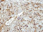 GK5 Antibody in Immunohistochemistry (Paraffin) (IHC (P))