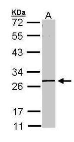 GK5 Antibody in Western Blot (WB)