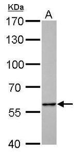 PKLR Antibody in Western Blot (WB)