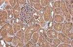 NFkB p65 Antibody in Immunohistochemistry (Paraffin) (IHC (P))