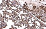 NFkB p65 Antibody in Immunohistochemistry (Paraffin) (IHC (P))