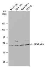 NFkB p65 Antibody in Western Blot (WB)