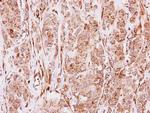 MMP19 Antibody in Immunohistochemistry (Paraffin) (IHC (P))