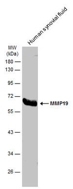 MMP19 Antibody in Western Blot (WB)