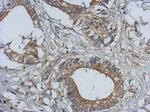 Bcl-10 Antibody in Immunohistochemistry (Paraffin) (IHC (P))