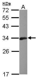 Bcl-10 Antibody in Western Blot (WB)