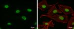 PARP1 Antibody in Immunocytochemistry (ICC/IF)