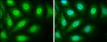 SMAD4 Antibody in Immunocytochemistry (ICC/IF)