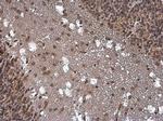 SMAD4 Antibody in Immunohistochemistry (Paraffin) (IHC (P))