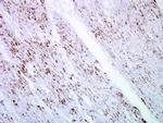 SMAD4 Antibody in Immunohistochemistry (Paraffin) (IHC (P))