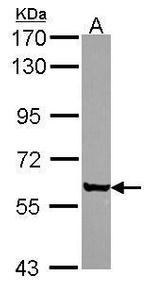 Coronin 2A Antibody in Western Blot (WB)