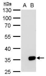 Galectin 8 Antibody in Western Blot (WB)