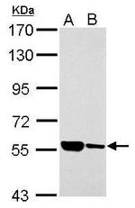 ILVBL Antibody in Western Blot (WB)