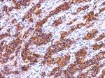 Galectin 4 Antibody in Immunohistochemistry (Paraffin) (IHC (P))