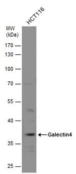 Galectin 4 Antibody in Western Blot (WB)