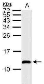 ENY2 Antibody in Western Blot (WB)