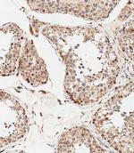 STRA8 Antibody in Immunohistochemistry (Paraffin) (IHC (P))