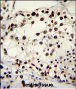 TRIM28 Antibody in Immunohistochemistry (Paraffin) (IHC (P))