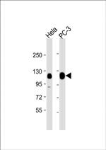 TRIM28 Antibody in Western Blot (WB)