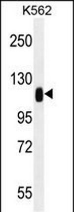 TRIM28 Antibody in Western Blot (WB)