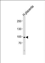 Ku80 Antibody in Western Blot (WB)