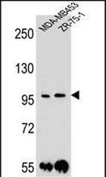 PCDH1 Antibody in Western Blot (WB)