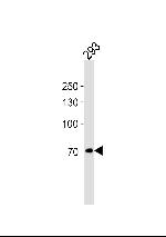 POU6F2 Antibody in Western Blot (WB)