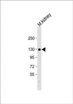 CACNA2D2 Antibody in Western Blot (WB)