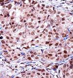 RAP1 Antibody in Immunohistochemistry (Paraffin) (IHC (P))