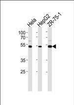 RAP1 Antibody in Western Blot (WB)