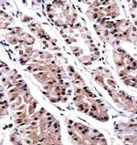 RUNX3 Antibody in Immunohistochemistry (Paraffin) (IHC (P))