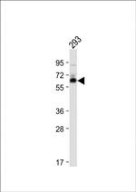 SMAD9 Antibody in Western Blot (WB)