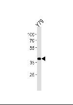 SIX3 Antibody in Western Blot (WB)