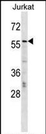 MTGR1 Antibody in Western Blot (WB)