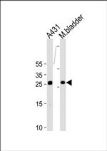 14-3-3 sigma Antibody in Western Blot (WB)