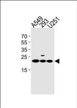 TMEM199 Antibody in Western Blot (WB)