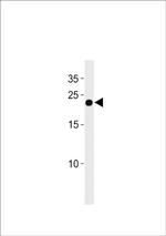 Interferon alpha-4 Antibody in Western Blot (WB)